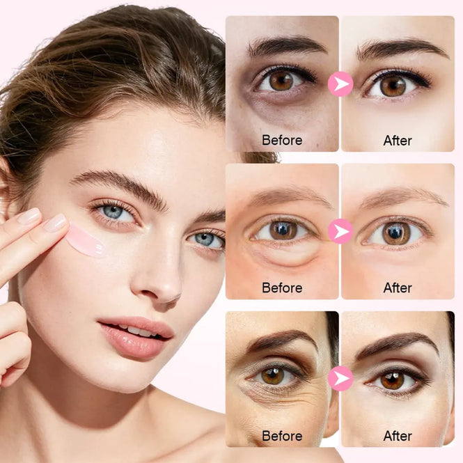 Dovaro™ PDRN eye cream
