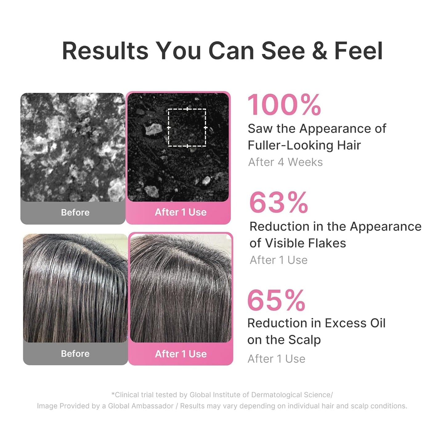 Rosemary PDRN Hair Care Set