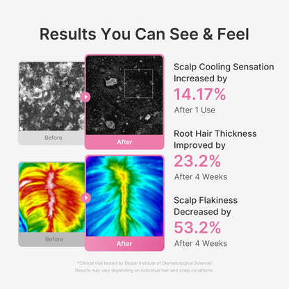 Rosemary PDRN Hair Care Set